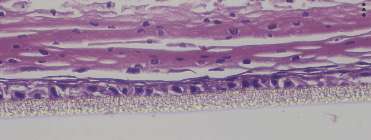 Psoriatic Skin (BioDPsor) histology