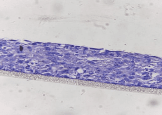 Vaginal Epithelium (BioDVag) histology