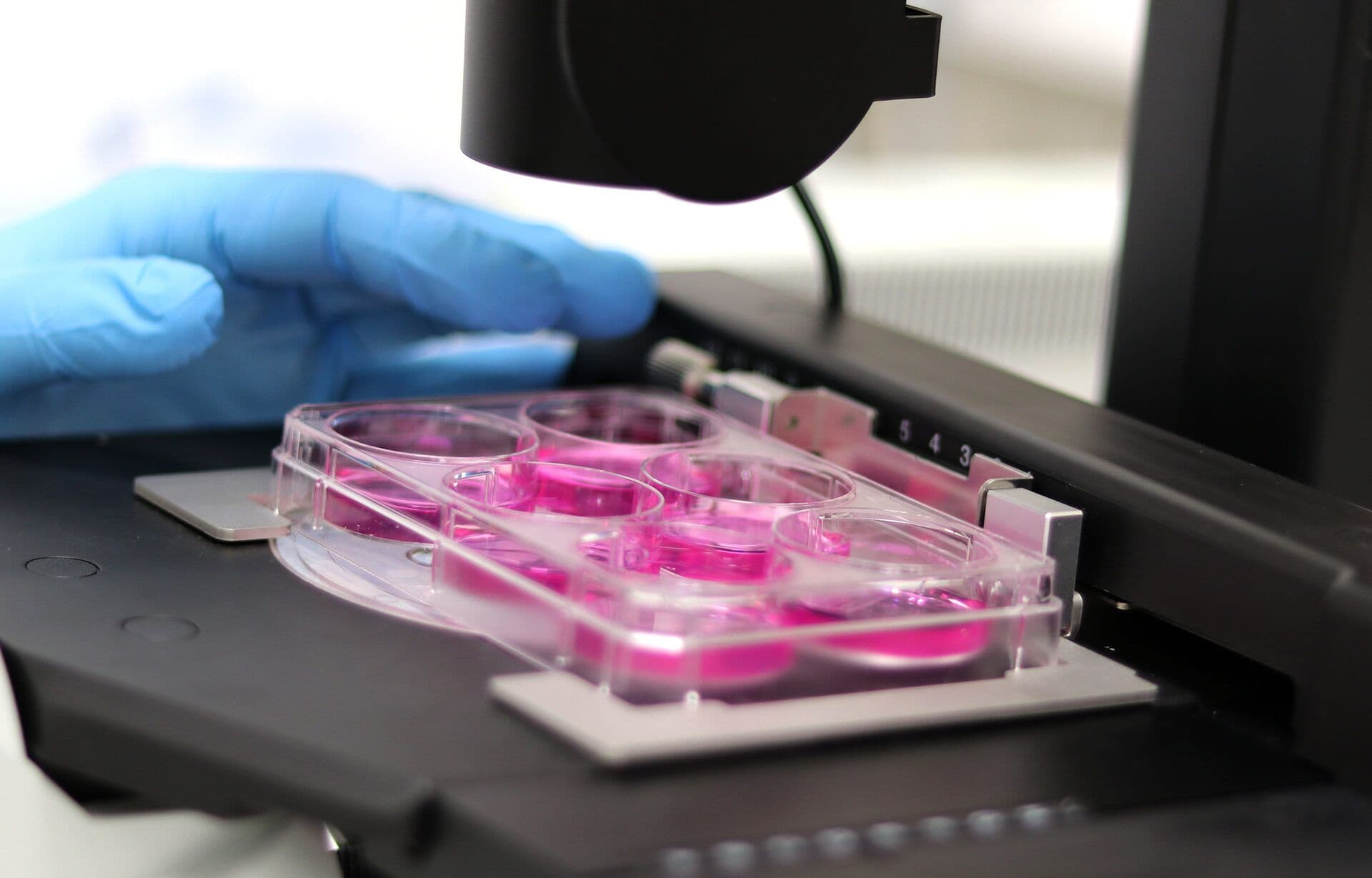 Patient-derived cancer organoids, explained