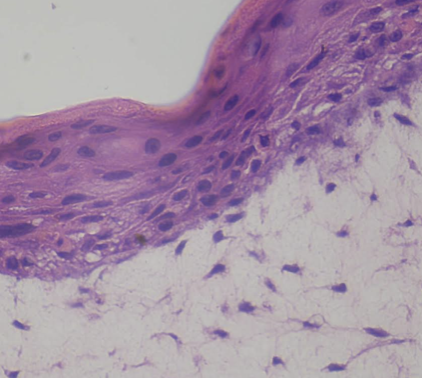 BioDFT - Human Full Thickness Skin