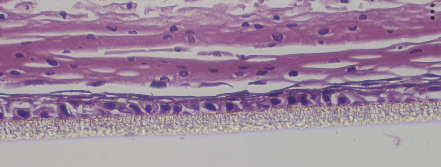 BioDPsor - Psoriatic skin model